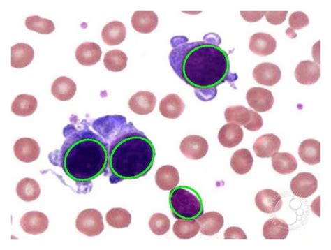 Resulting images of the first test after applying the WBC detector: (a)... | Download Scientific ...