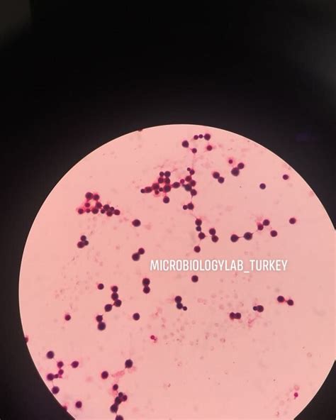 Exploring the Fascinating World of Cryptococcus Neoformans