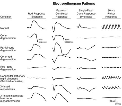 ERG changes - American Academy of Ophthalmology