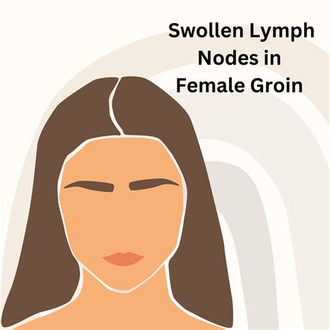 Swollen Lymph Nodes in the Groin in Females | Young Earth Sanctuary