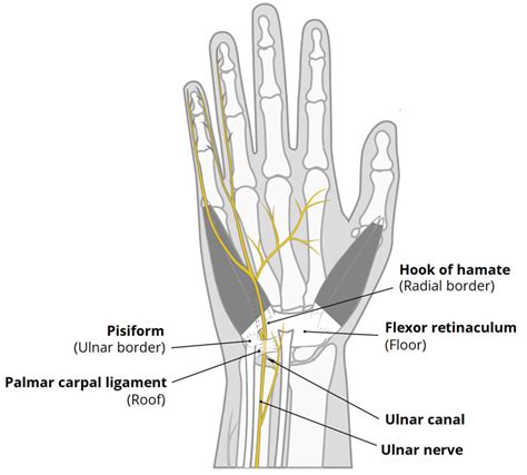 The Ulnar Canal - Guyon's - Borders - Contents - Compression - TeachMeAnatomy