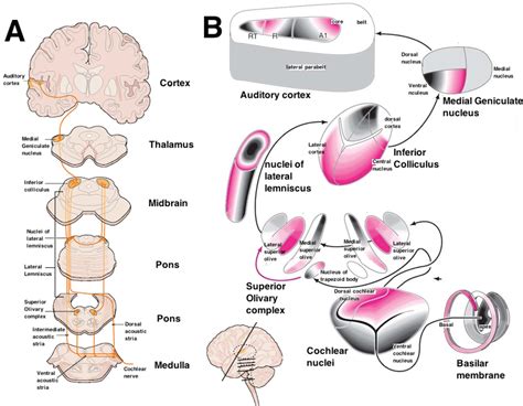 Figure 1 from Neuroanatomical and perceptual deficits in auditory agnosia : a study of an ...