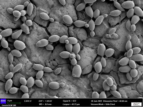 A yeast responsible for horse sweat in wine: the Brettanomyces bruxellensis - France-BioImaging