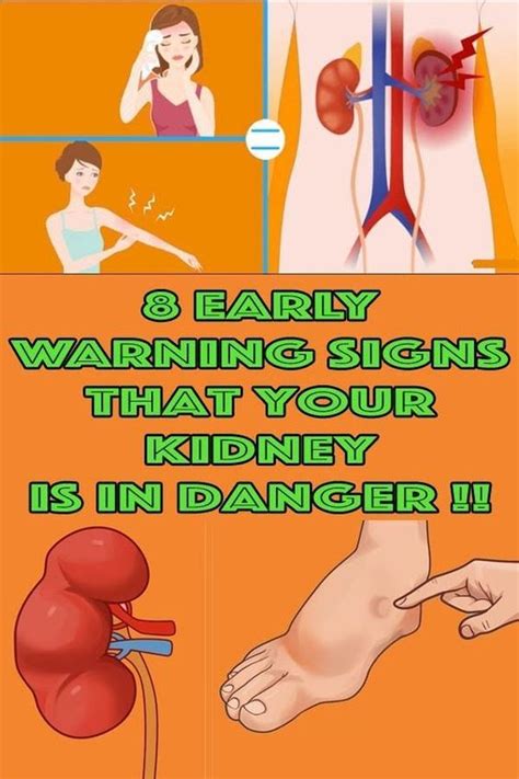 8 Warning Symptoms of Kidney Damage | Kidney damage, Health and fitness tips, Health resolutions