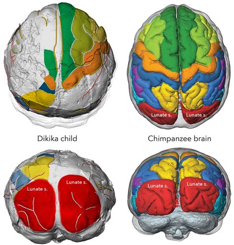 Man's ancestors had ‘ape-like brain structure but human-like brain growth' - The Irish News