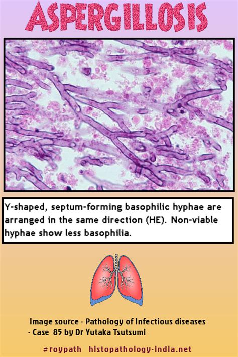 Aspergillus fumigatus is the species most frequently isolated from patients with invasive or ...