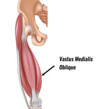 Vastus Medialis Oblique Rehab | Knee Rehabilitation