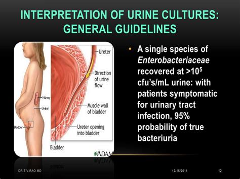 PPT - Interpretation of Urine Cultures PowerPoint Presentation, free download - ID:212996