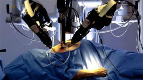 Robotic Surgery, Does It Right For You? - You Need to Know - Avens Blog | Avens Blog