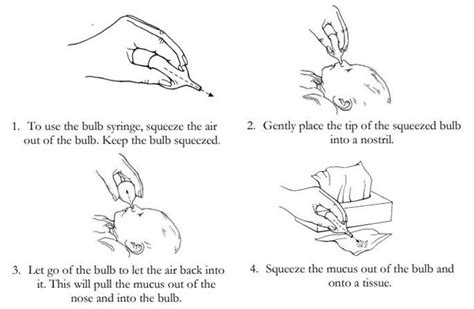 Suctioning The Nose With A Bulb Syringe