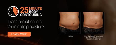 SculpSure Laser Body Contouring treatment now available! | Tanghetti, MD