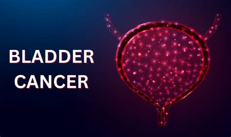 Understanding Bladder Cancer Treatment Options | Vaidam Health