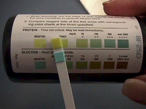 Pregnancy Symptoms Urine Color