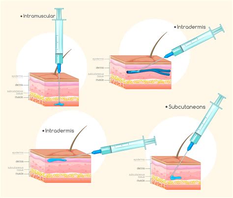 4 Types Of Injection