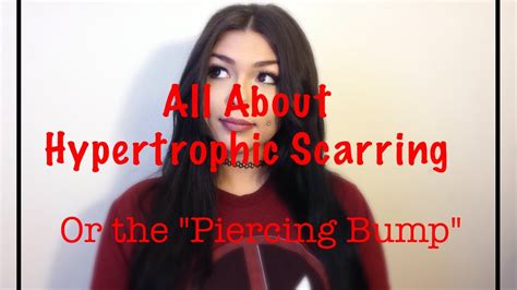 All About Hypertrophic Scarring (Piercing Bump) |Piercing |NativeBeauty - YouTube