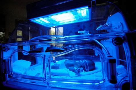 Bili Lights Phototherapy For Jaundice | Shelly Lighting