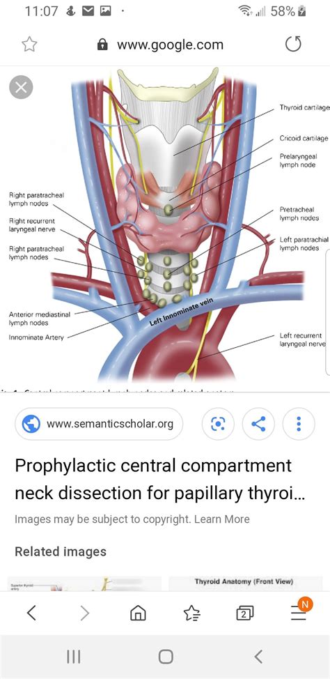 Pin by Jeanne on Anatomy | Lymph nodes, Arteries, Dissection