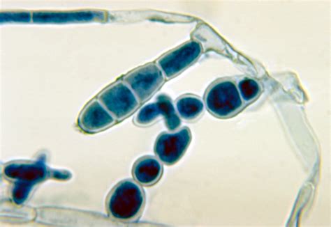 Archivo:Epidermophyton floccosum 01.jpg - Wikipedia, la enciclopedia libre