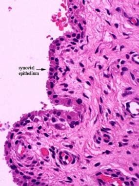 Synovial Membrane Histology