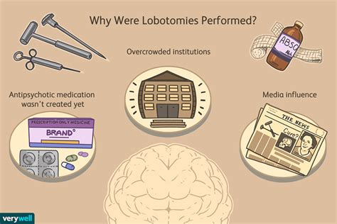 Lobotomy: Definition, History, and Usage