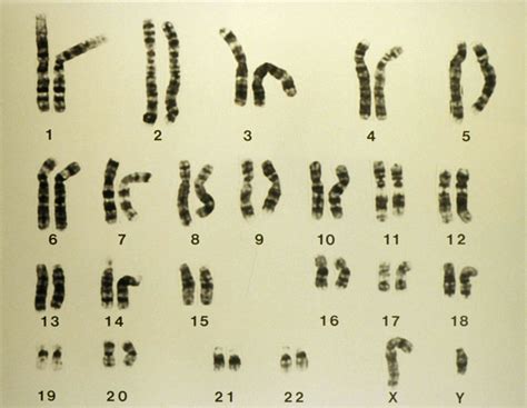 Heterozygote versus homozygote verschillen - Med NL