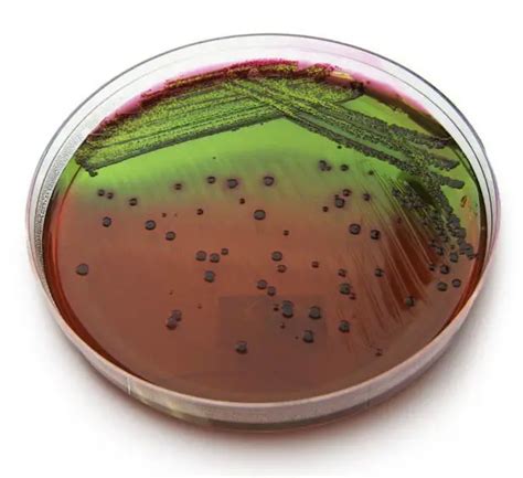 Eosin Methylene Blue (EMB) Agar : Composition, uses and colony ...