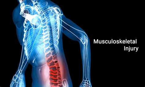 Musculoskeletal diagnosis can be improved with 3D imaging