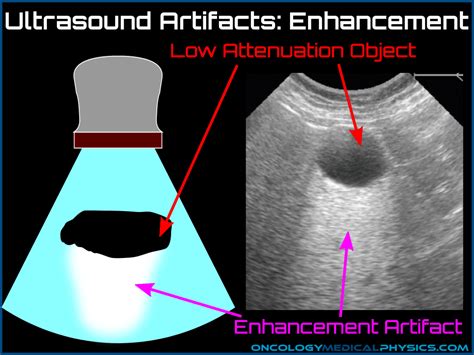 Ultrasound | Oncology Medical Physics