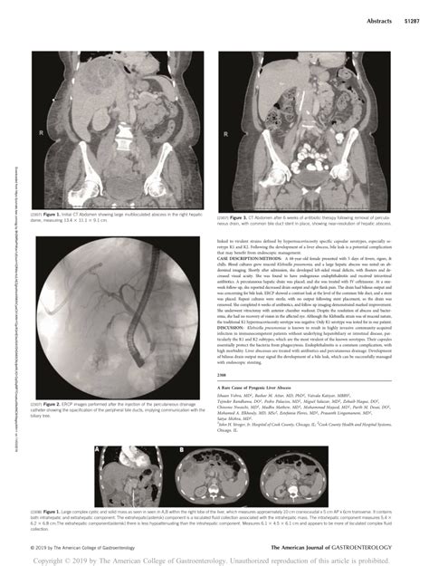 (PDF) A Rare Cause of Pyogenic Liver Abscess: 2308