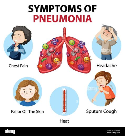 Symptoms of pneumonia cartoon style infographic illustration Stock ...