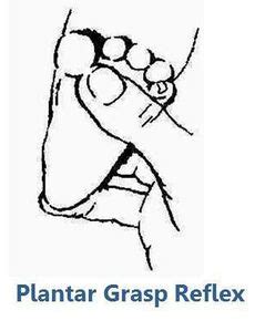 Plantar Grasp Reflex - Physiopedia