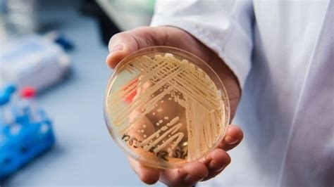 What is Candida auris? Washington state sees deadly fungal infection ...