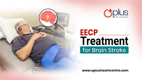 EECP Treatment for Brain Stroke - Oplus Heart Centre | EECP