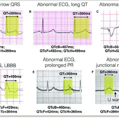 Histogram of doxorubicin dose by formulation and type of administration ...