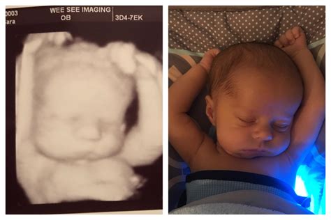 Adorable: Baby sleeps in the same position as in his ultrasound photos