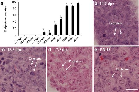 Diplotene stage oocytes are first detected at 17.5 dpc. a Percentage of... | Download Scientific ...