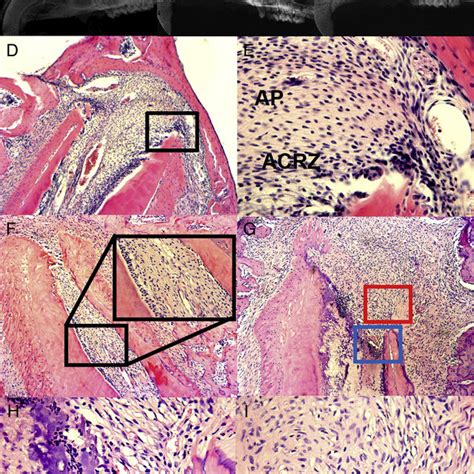 Sixty days: (A) root showing remaining tissue in the apical third... | Download Scientific Diagram