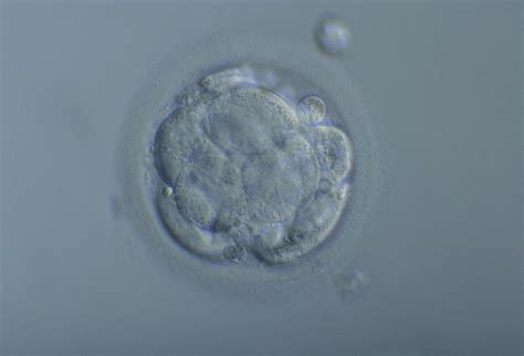 Morula Embryo Photograph by Pascal Goetgheluck/science Photo Library ...