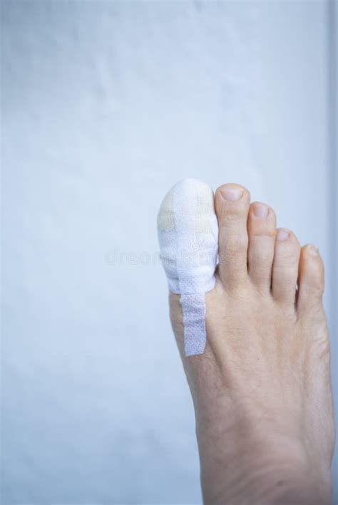 Foot Big Toe Bandage Injury Stock Image - Image of injury, treatment: 232037481