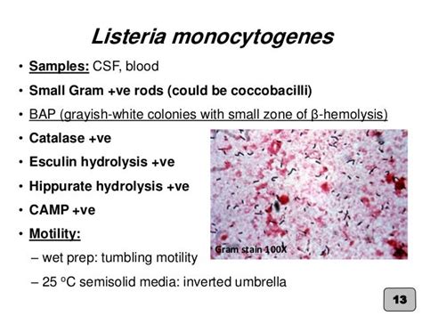 Listeria Gram Stain - Gram Stains