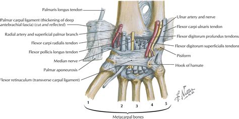 Acute Carpal Tunnel Syndrome - Orthopedic Clinics