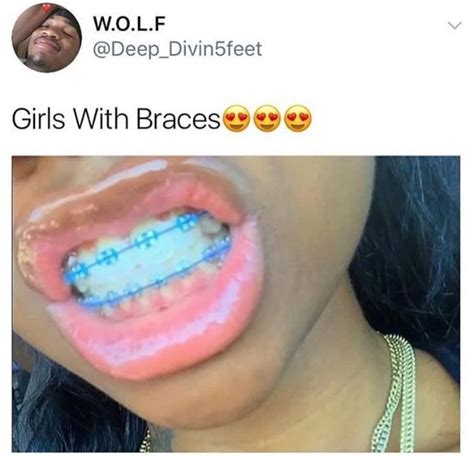 Liberty | Braces colors, Cute braces, Cute braces colors