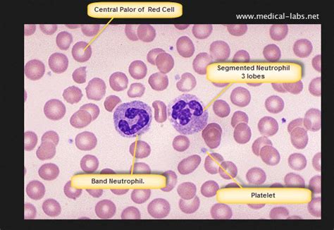 Normal Red Blood Cells on peripheral blood smear | Medical Laboratories