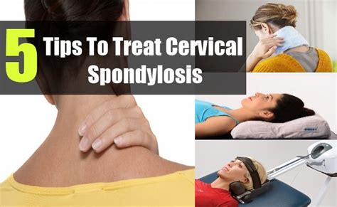 Tips To Treat Cervical Spondylosis | Cervical spondylosis, Cervical spinal stenosis, Cervical