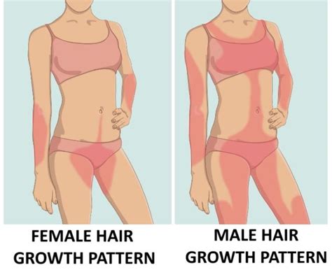 Excess Hair Growth In Women Is A Symptom You Shouldn't Ignore | Funzug.com