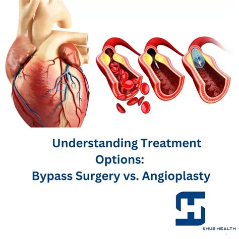 PPT - Bypass Surgery vs. Angioplasty PowerPoint Presentation, free ...