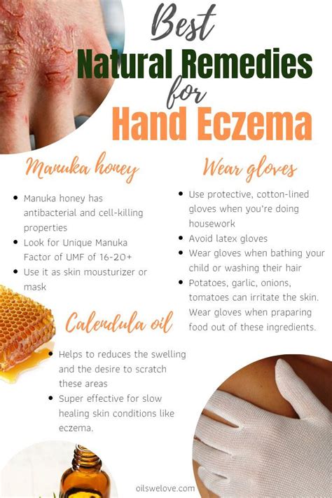 How to use manuka honey for eczema and cure it naturally | Eczema ...