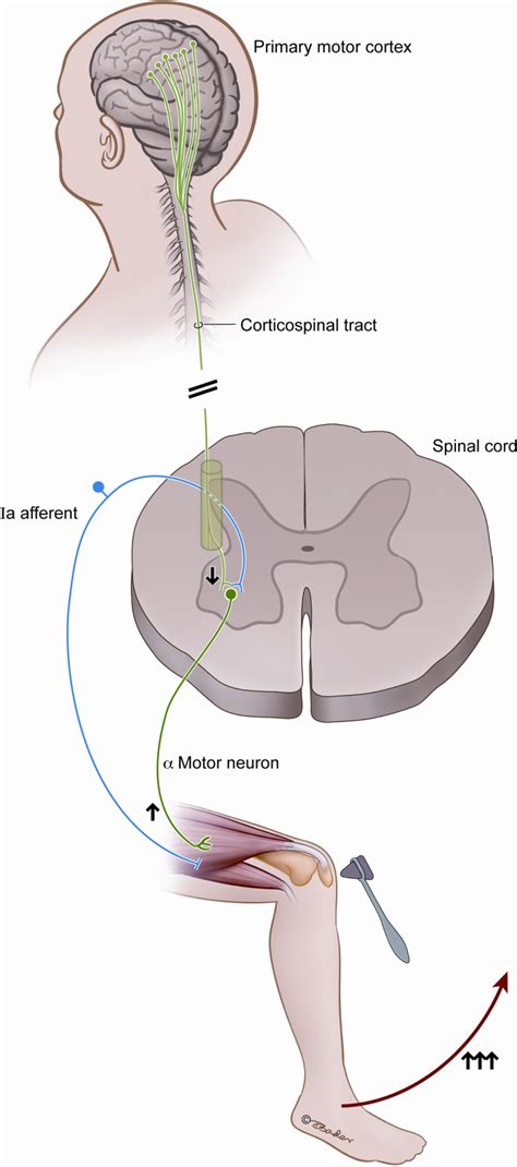 This figure illustrates the classically described spinal reflex arc and ...