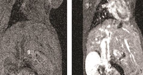 New MRI contrast agents | Feature | Chemistry World