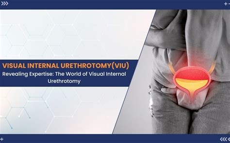 Optimal Urological Care: 1 Navigating Visual Internal Urethrotomy (VIU) at the Best Hospital in ...